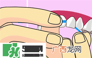 牙齿美白的方法有那些牙齿美白心得