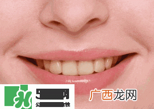 牙齿美白的方法有那些牙齿美白心得