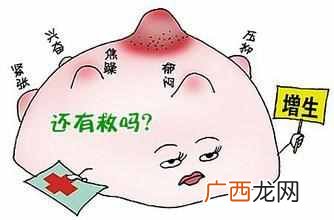 乔布斯怎么死的？真的是因为癌症吗