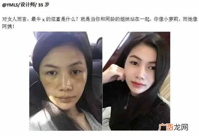 怎么祛斑最有效？大家都在用的方法，你也试试