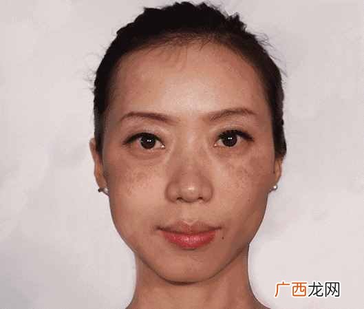 怎么祛斑最有效？大家都在用的方法，你也试试