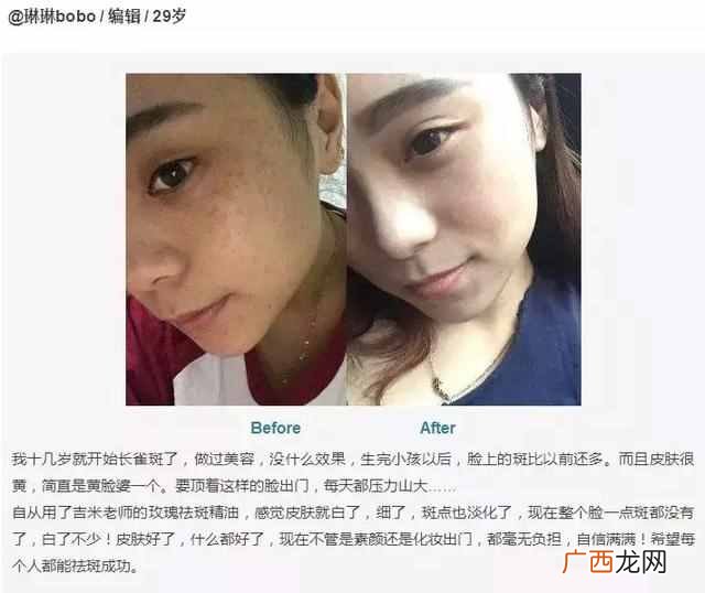 怎么祛斑最有效？大家都在用的方法，你也试试