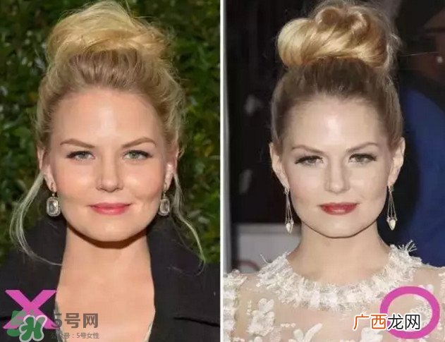 新打耳洞戴什么材质的耳钉好？打耳洞用什么消毒最好
