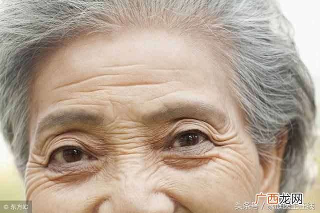 眼睛有皱纹怎么办？一招帮你缓解困扰