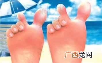 香港脚怎么治才能根除？教你一招彻底治疗