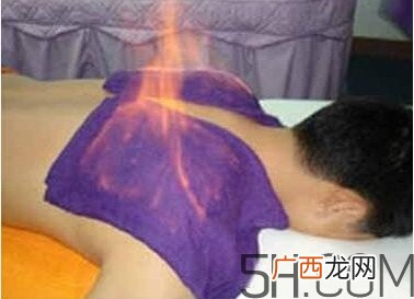 火疗真的能治病吗？火龙液的功效与作用