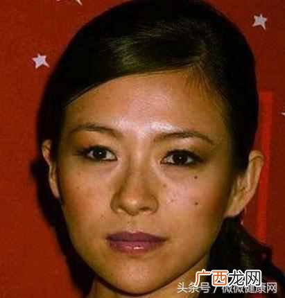 怎么去色斑？用这个方法终于把困扰我多年的色