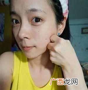 怎么瘦脸最快？瘦成瓜子脸就这么简单