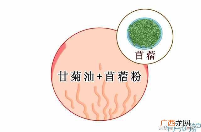 妊娠纹怎么办？10种方法，总有一种适合你
