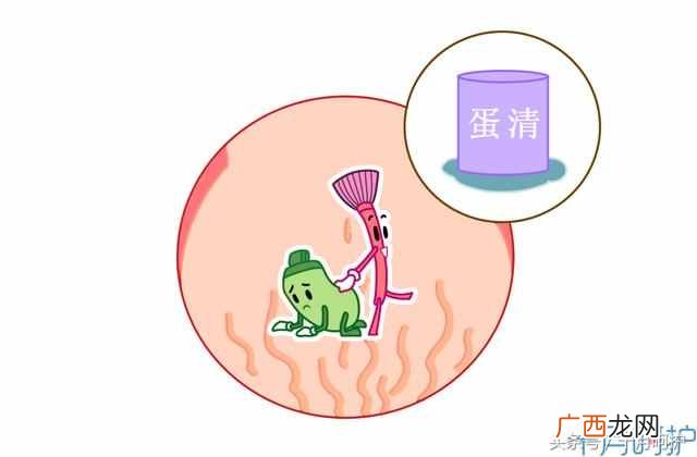 妊娠纹怎么办？10种方法，总有一种适合你
