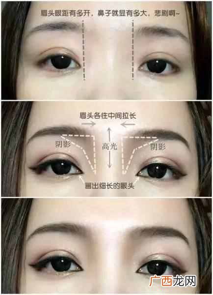 鼻子塌怎么办？教你一招从此告别塌鼻梁