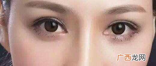 怎么能让眼睛变大？眼睛变大有妙招，赶紧试试
