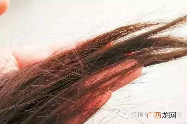 教你几招解决脱发原因 爱掉头发怎么办