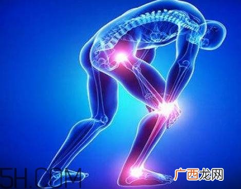 关节炎是冻出来的吗？关节炎和风湿的区别在哪里？