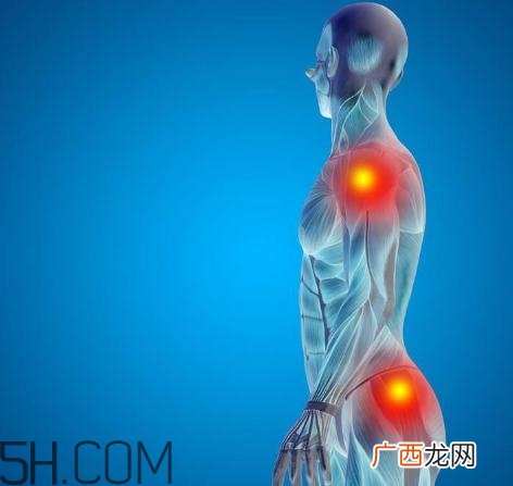 关节炎能吃螃蟹吗?关节炎能吃海鲜吗?
