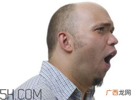 什么样的人容易秃顶？为什么女人不秃顶