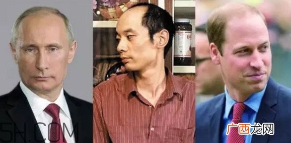 为什么会秃顶？秃顶的人聪明吗
