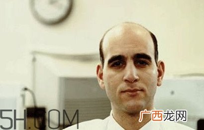秃顶了还能长出头发吗？秃顶和性欲太强是不是有关
