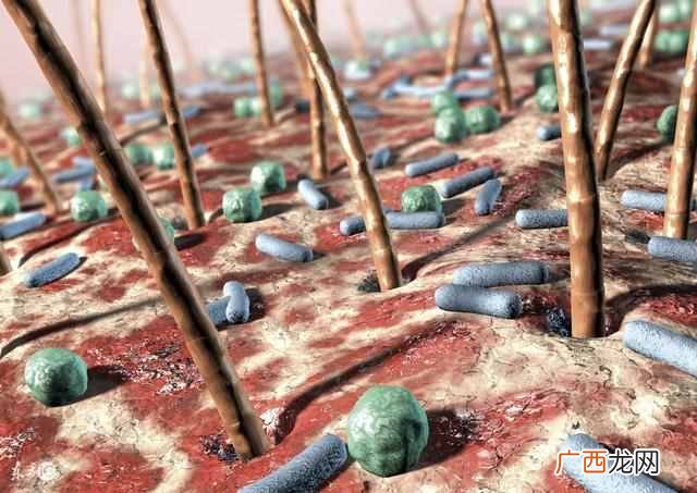 怎么治疗脱发最有效的方法？治疗脱发秘方
