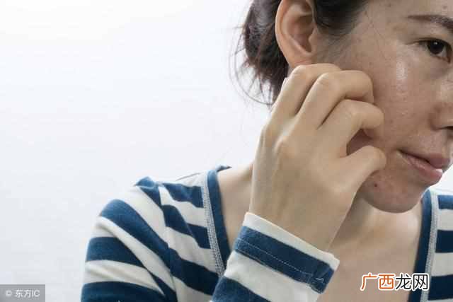 脸上有黄褐斑怎么办？彻底根治有方法