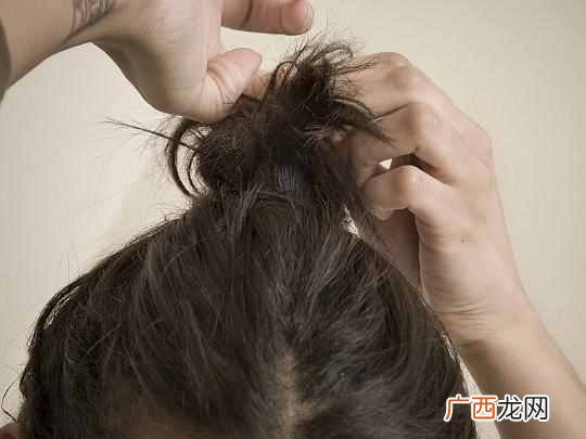 头发稀少怎么变浓密？头发变浓密这个方法特管
