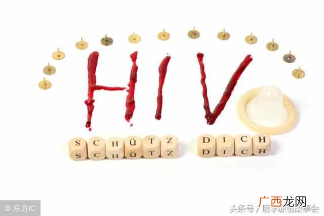 艾滋病症状有哪些？艾滋病的潜伏期你知道吗