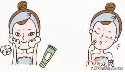 脸上长痘痘怎么办啊？祛痘有妙招，土方法太管