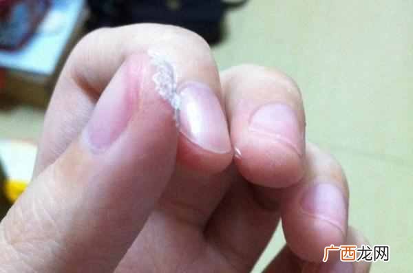 手上有胶水怎么洗？快速去除的方法