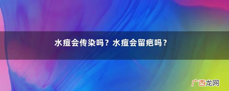 水痘会传染吗?水痘会留疤吗?
