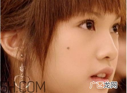 痣是怎么形成的?女人痣长哪里最有福气