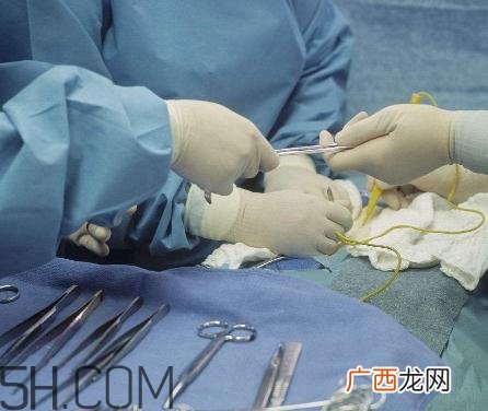 包茎手术可以用医保吗？包茎手术能报销吗？