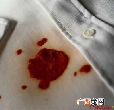 衣服上铁锈怎么洗掉？用这个方法一点痕迹都没