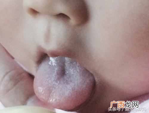 婴儿舌苔厚白是怎么回事，婴儿舌苔发白正常吗