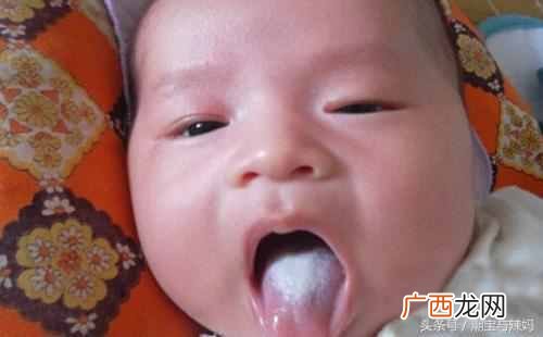 婴儿舌苔厚白是怎么回事，婴儿舌苔发白正常吗
