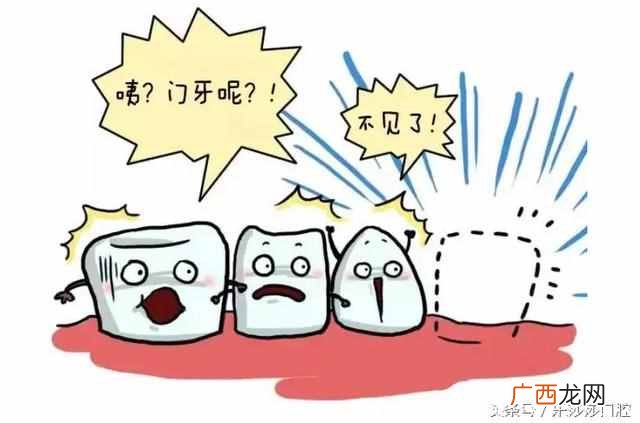 临时解决办法 大门牙掉了怎么办