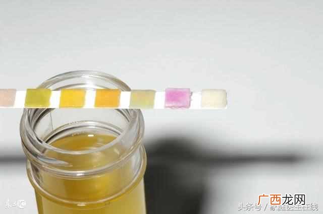 偶尔尿分叉是怎么回事（这是前列腺的症状吗？