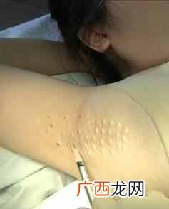 教你一招去除腋下异味 腋下有异味怎么办