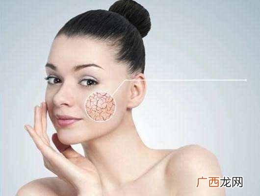脸上红血丝怎么办,几个偏方教你快速去除!