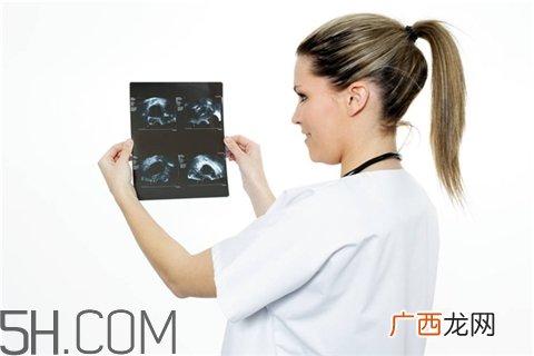 骨折会影响月经吗？骨折对性功能有影响吗？
