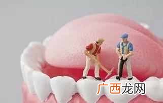 牙缝怎么补，牙齿保健技巧！