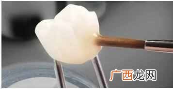 牙缝怎么补，牙齿保健技巧！