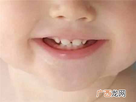 牙缝怎么补，牙齿保健技巧！