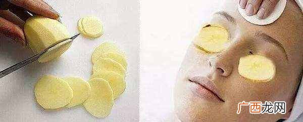 怎么去除眼袋，教你几个步骤解决！