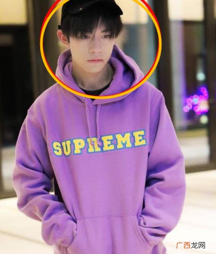 易烊千玺脸上的疤，易烊千玺久违出现