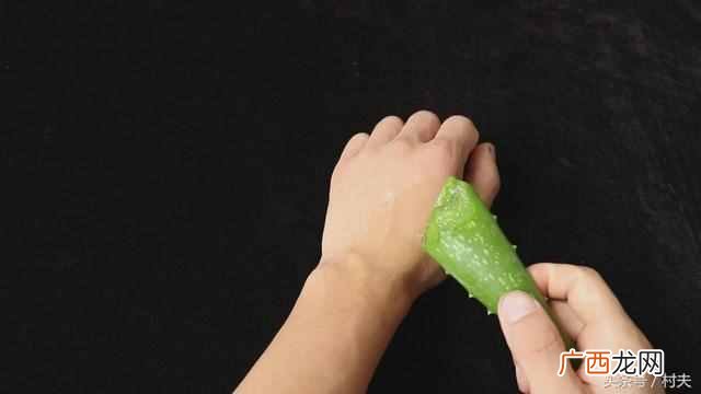 烫伤起泡怎么处理,处理时需要注意这些方面!