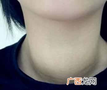 甲状腺炎怎么治疗，甲状腺炎有哪些症状！