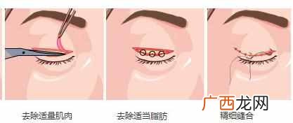 眼睛怎么变大，几个技巧就可以！