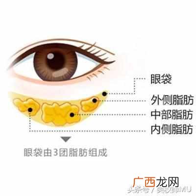 眼袋是怎么形成的，教你怎么缓解眼袋问题！
