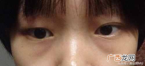 眼袋是怎么形成的，教你怎么缓解眼袋问题！