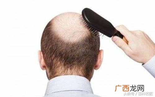 脱发怎么办，教你几招告别脱发！